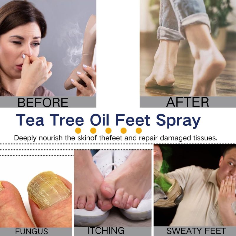 2Pcs Foot Spray With Tea Tree Oil - Image 6